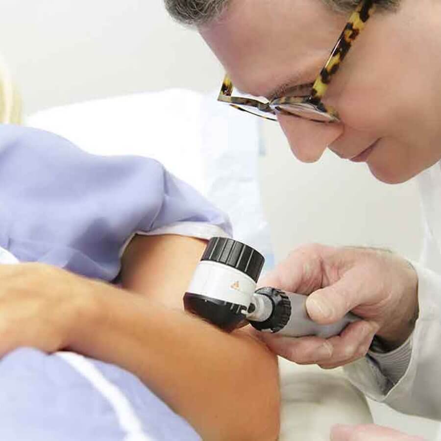 Skin Cancer Early Detection